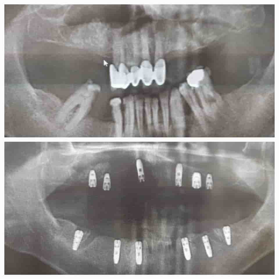 Verifizierte Patientenbewertungen von Prestij Dental Clinic in Antalya, Turkey Slider image 8