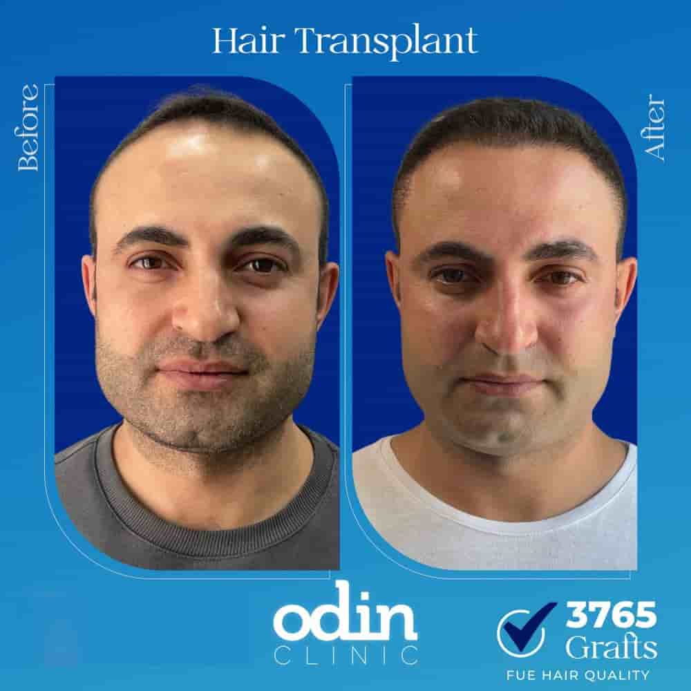 Verifizierte Patientenbewertungen von Odin Clinic in Izmir, Turkey Slider image 3