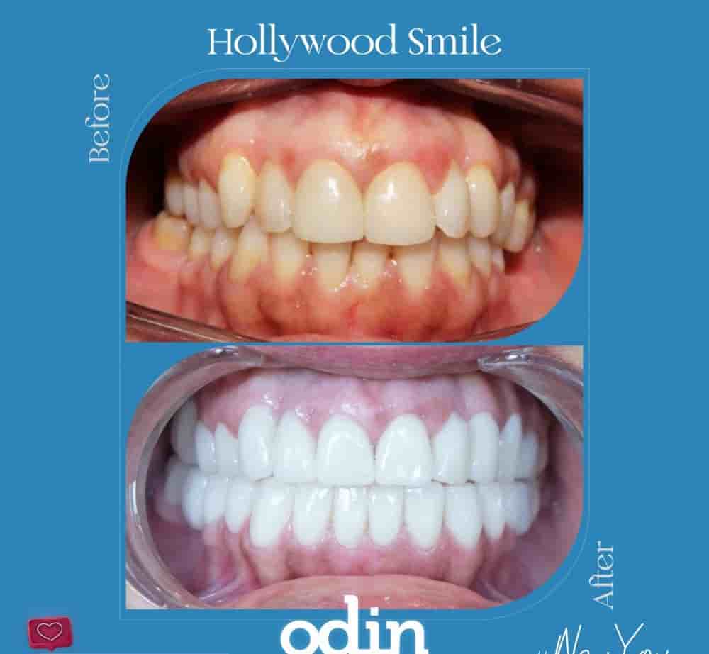 Verifizierte Patientenbewertungen von Odin Clinic in Izmir, Turkey Slider image 5