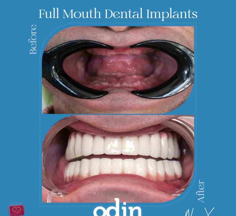 Verifizierte Patientenbewertungen von Odin Clinic in Izmir, Turkey Slider image 6