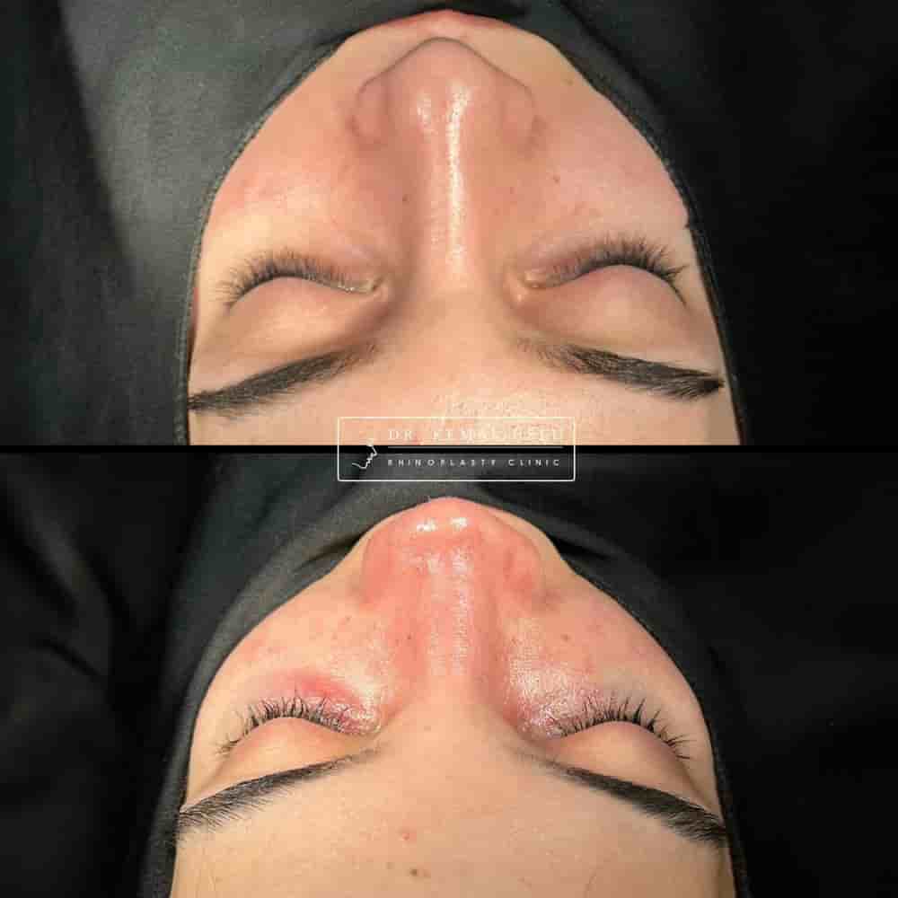 Verifizierte Patientenbewertungen von Dr. Kemal Uslu Clinic in Istanbul, Turkey Slider image 3