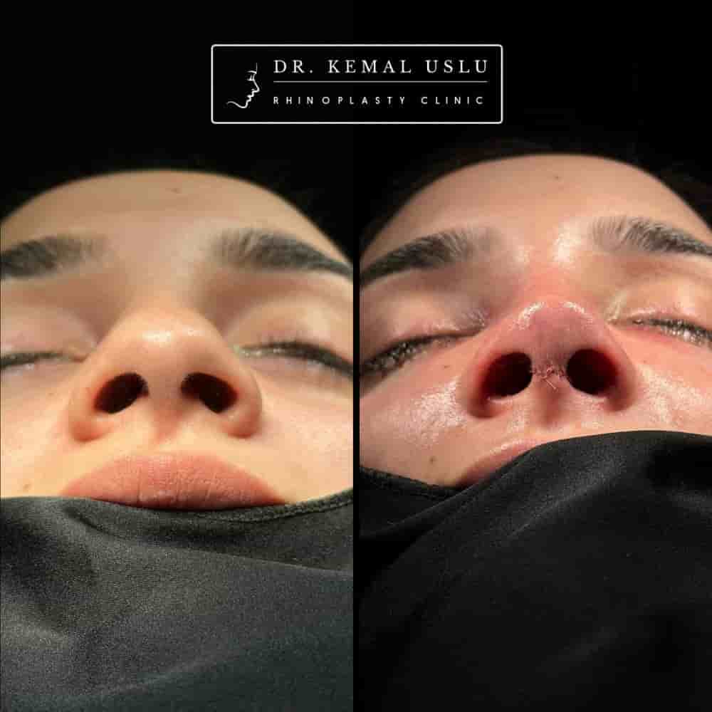 Verifizierte Patientenbewertungen von Dr. Kemal Uslu Clinic in Istanbul, Turkey Slider image 4