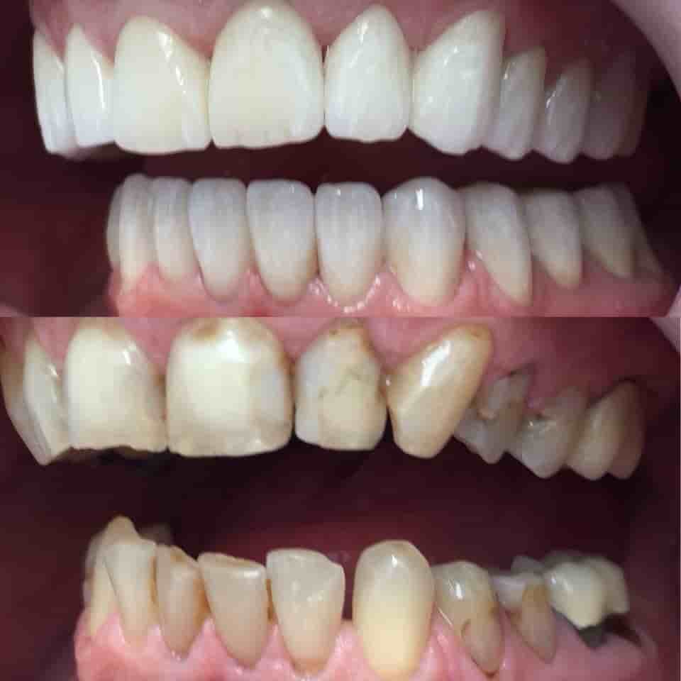 Verifizierte Patientenbewertungen von Dr. Erdal Kumkumoglu - Praktijk Istanbul in Istanbul, Turkey Slider image 5
