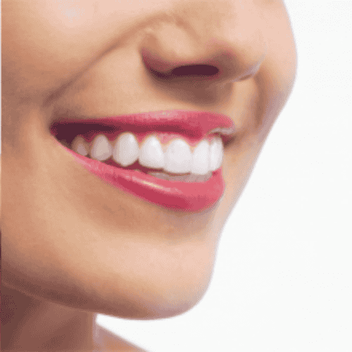 Smile Makeover-Paket der Bergedent Clinic in Istanbul, Türkei