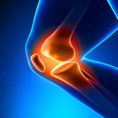 Stammzelltherapie für Gelenke in Mexiko-Stadt, Mexiko, in der MexStemCells Clinic