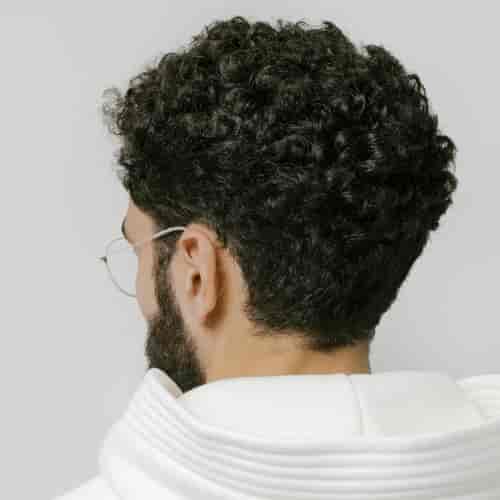 Haartransplantationspaket – Von 2.001 bis 3.500 Grafts