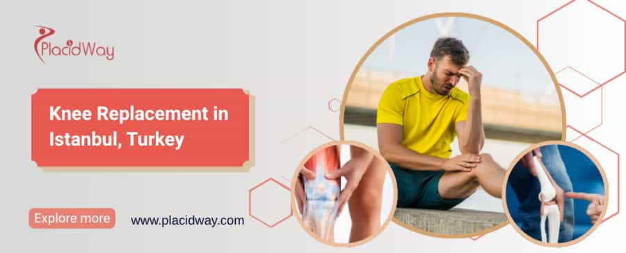 Knieersatz in Istanbul, Türkei thumbnail