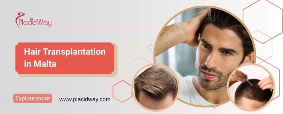 Haartransplantation in Malta thumbnail