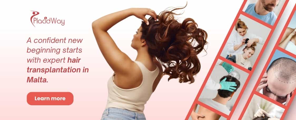 Haartransplantation in Malta thumbnail