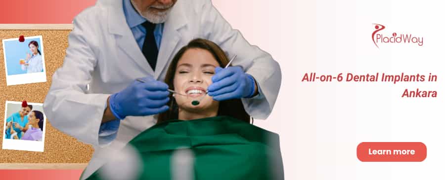 All-on-6 Implantate Ankara, Türkei thumbnail