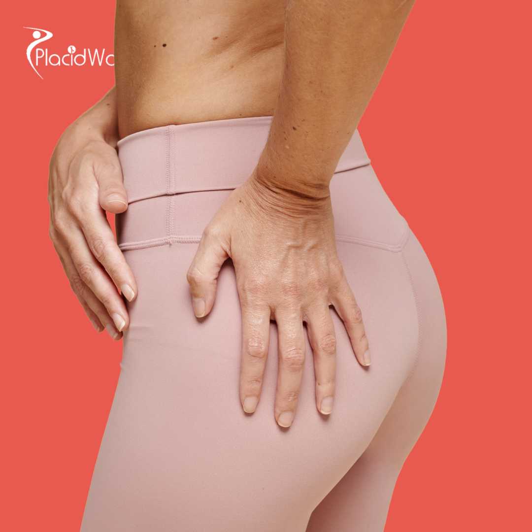 Brasilianisches Po-Lifting in Griechenland