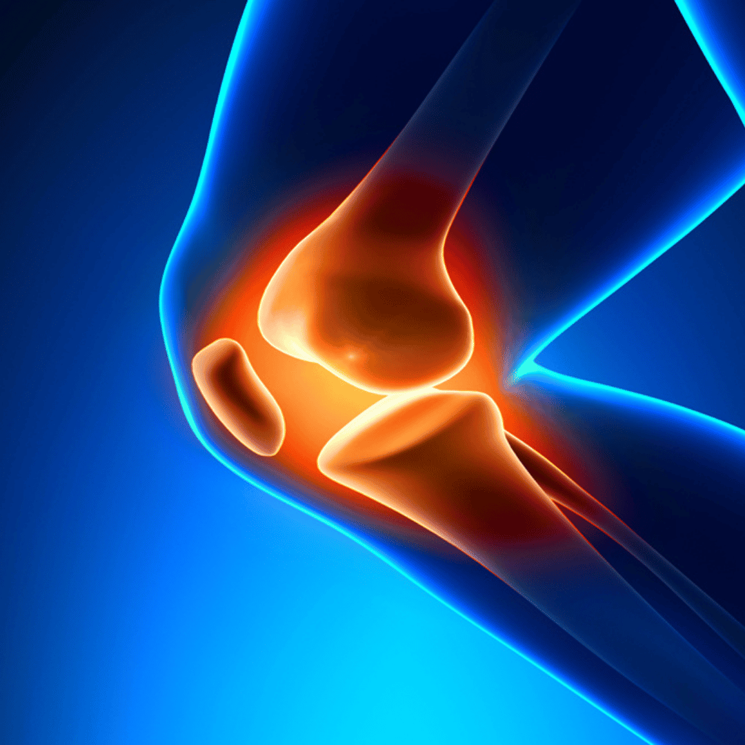 Stammzelltherapie für Gelenke in Mexiko-Stadt, Mexiko, in der MexStemCells Clinic