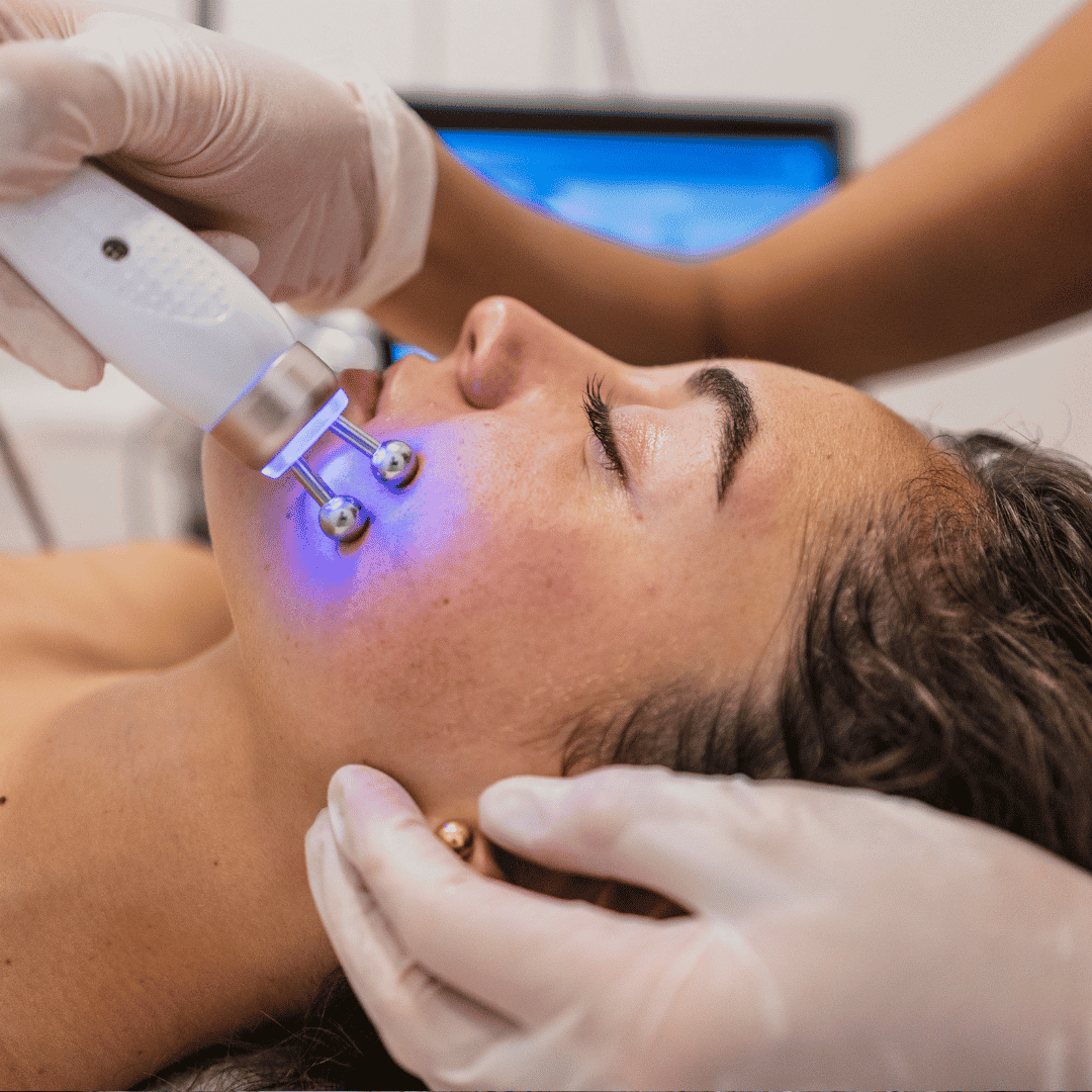 Laser Skin Treatments