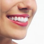 Smile Makeover-Paket der Bergedent Clinic in Istanbul, Türkei thumbnail
