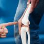 Arthroskopisches Meniskusreparaturpaket thumbnail