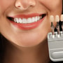 Smile Makeover in Istanbul – Hollywood-Lächeln, Implantate, Kronen in Istanbul thumbnail