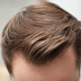 FUE-Haartransplantation in der Bellus Clinic – holen Sie sich Ihr Haar zurück mit der Bellus Clinic thumbnail